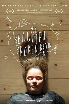 My Beautiful Broken Brain
