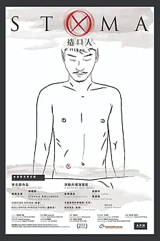 Stoma
